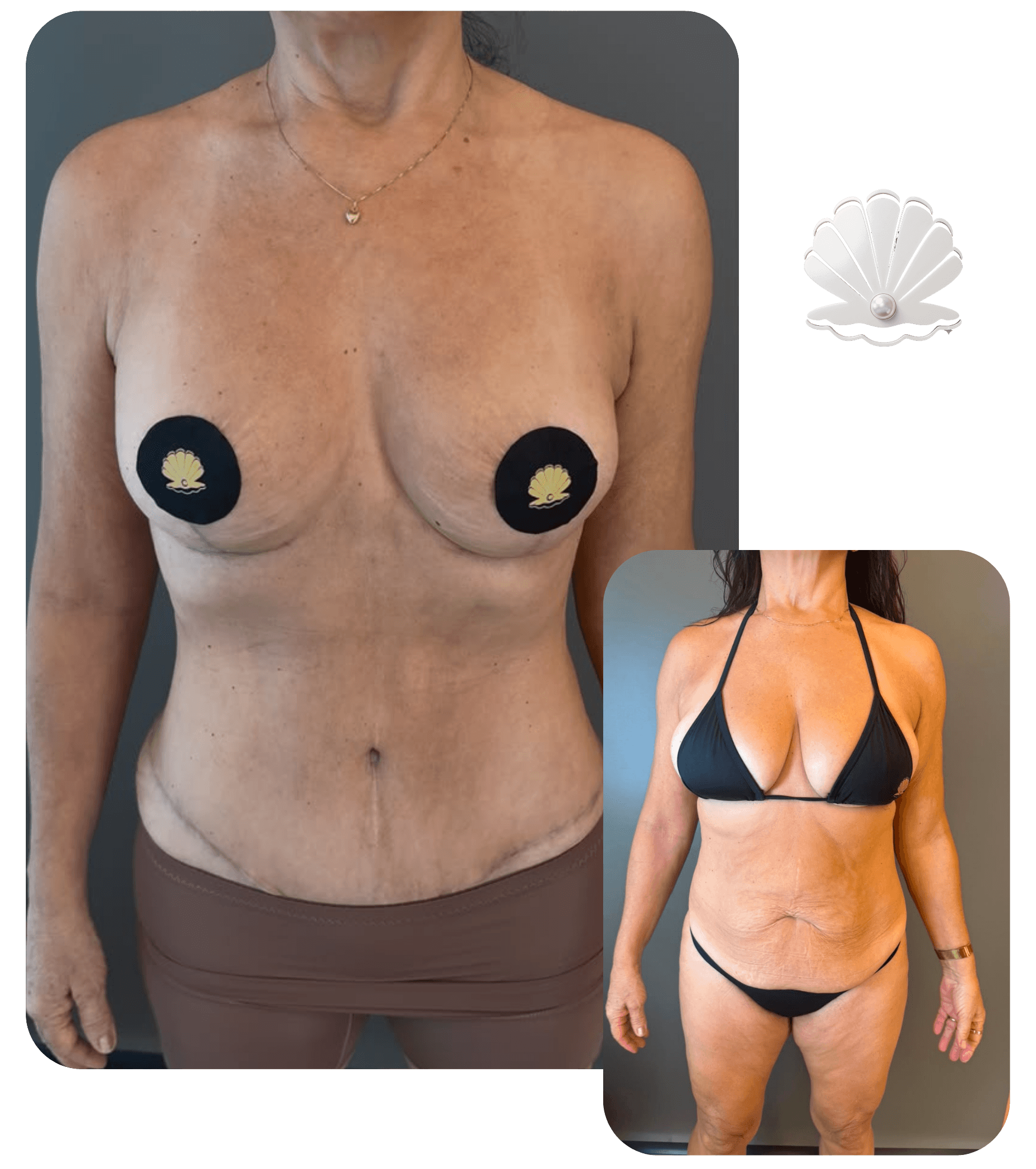 Resultado antes e depois