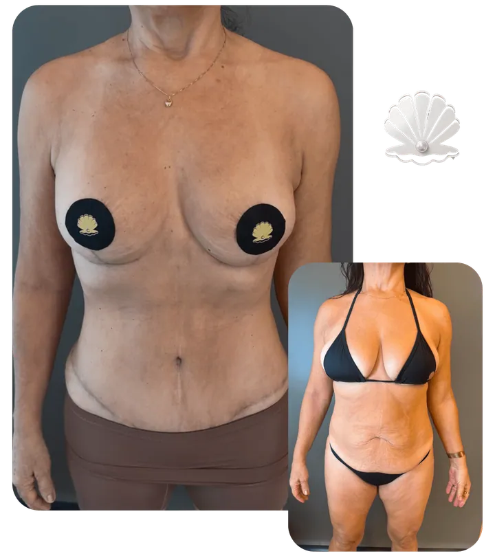 Resultado antes e depois