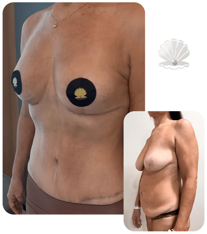 Resultado antes e depois