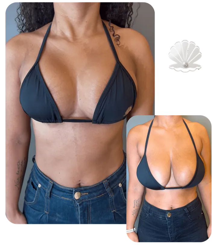 Resultado antes e depois