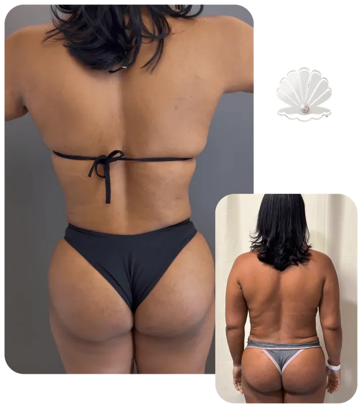 Resultado antes e depois