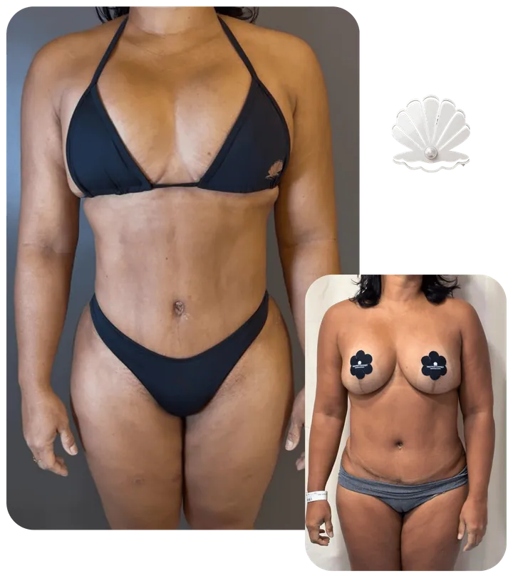 Resultado antes e depois